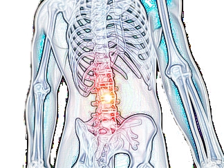 筋・筋膜性腰痛の図