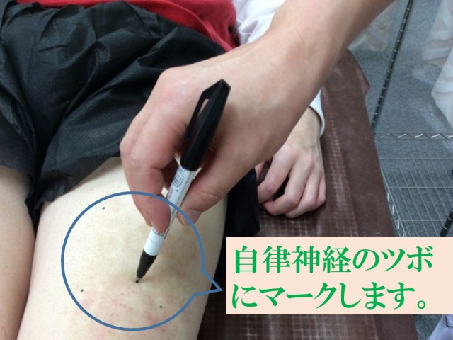 自律神経失調 ツボにマークします