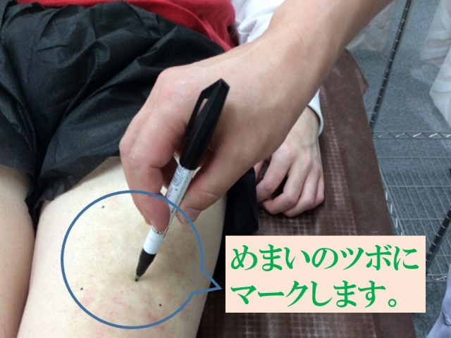 めまい ツボにマークします