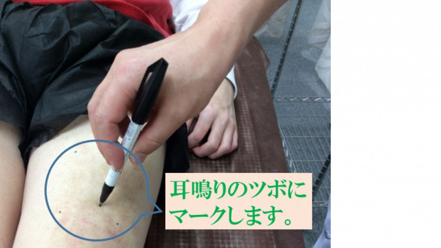 耳鳴り ツボにマークします