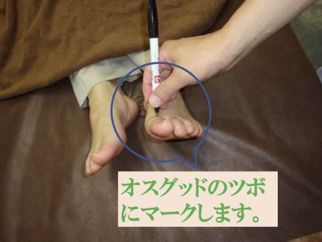 オスグッド　マーク